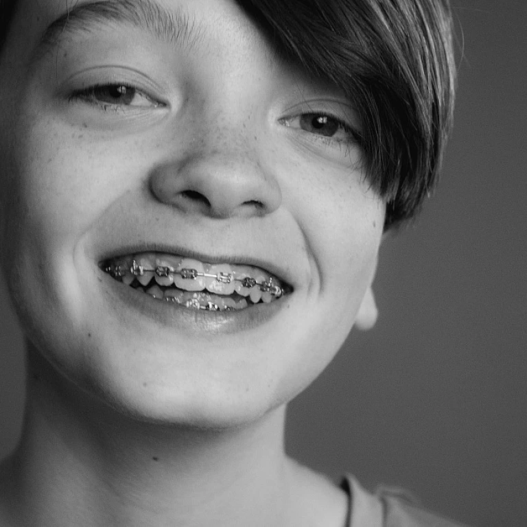 Les avantages des dents en céramique pour votre appareil dentaire