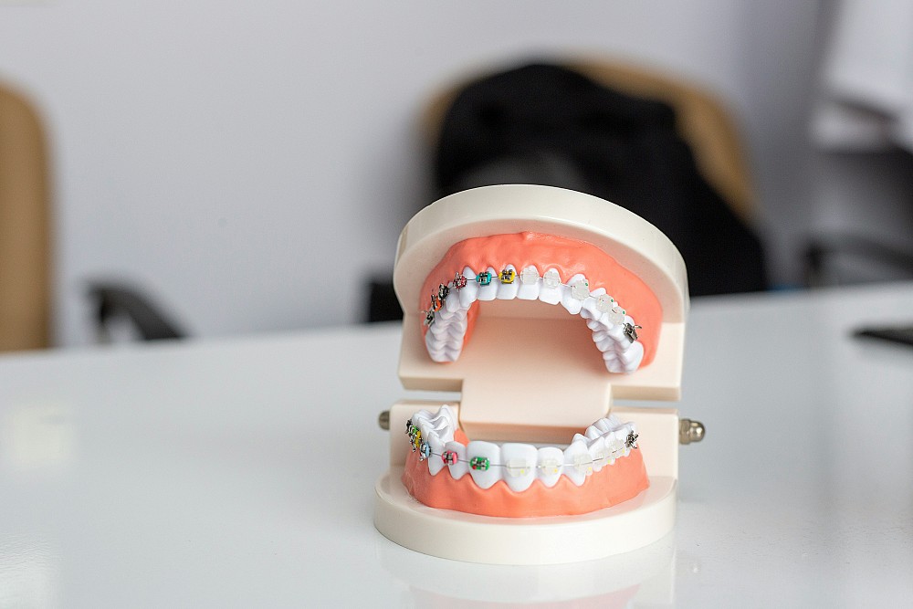Comment choisir la colle pour réparer un dentier en pharmacie — free download