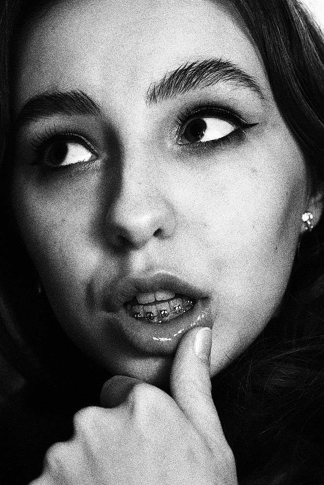 Comprendre le vrai prix pour appareil dentaire adulte et choisir le bon traitement